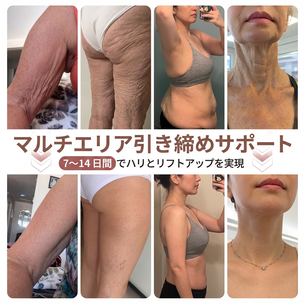 💫HISKIN® バストラインケア リフト＆ハリ ナノマイクロニードルパッチ ✅