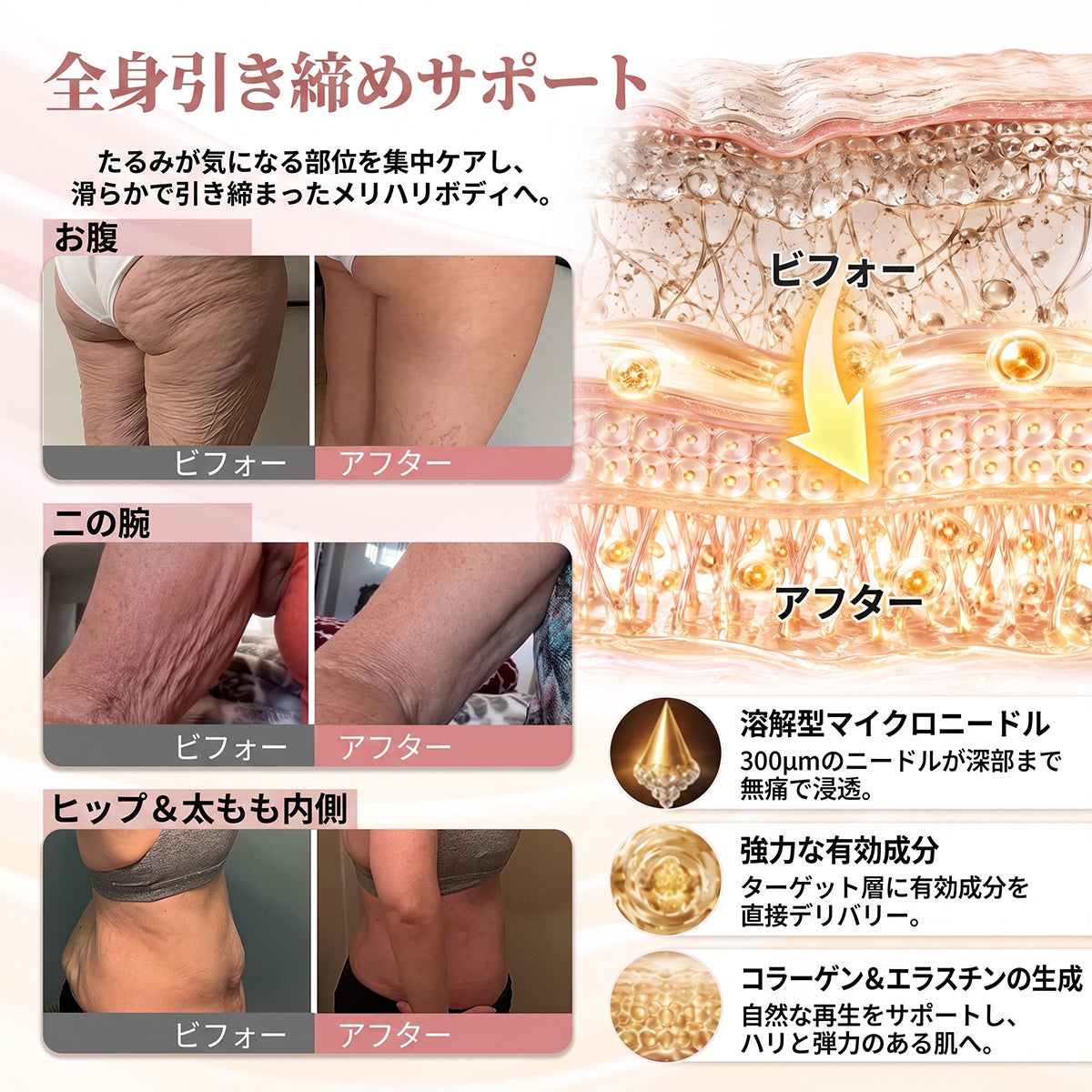 💫HISKIN® バストラインケア リフト＆ハリ ナノマイクロニードルパッチ ✅